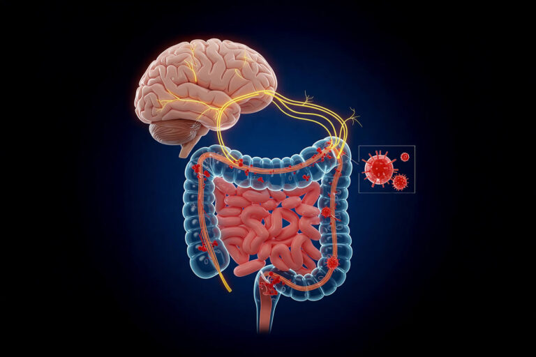 MICI&nbsp;: ce facteur invisible qui peut précipiter les rechutes… Même quand la maladie semble sous contrôle.