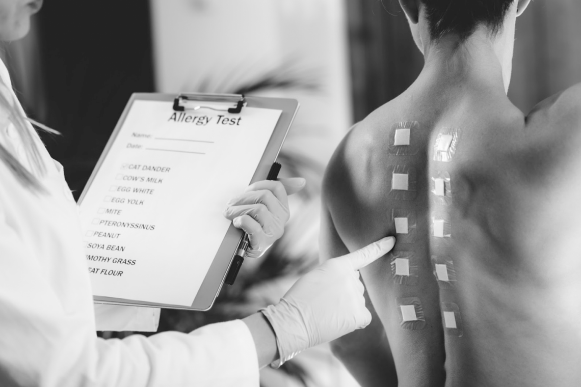 Une réaction allergique cutanée se produit lorsque le système immunitaire reconnaît un allergène et y réagit