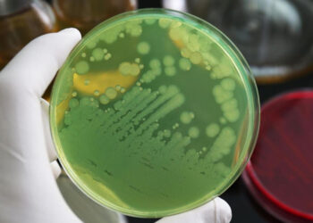 Impact croissant des infections fongiques sur la mortalité mondiale et urgence d'une meilleure prise en charge microbiologique.