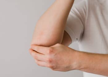 Het belang van een vroege diagnose van psoriasisartritis voor het starten van een behandeling met biologicals en het beperken van onomkeerbare gewrichtsschade