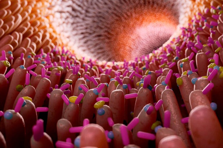 Intestinale microbiota en artrose
