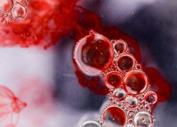 Bon usage des antithrombotiques en cardiologie&nbsp;: synthèse des contre-indications formelles des anticoagulants oraux directs (AOD) par rapport aux antivitamines K (AVK).