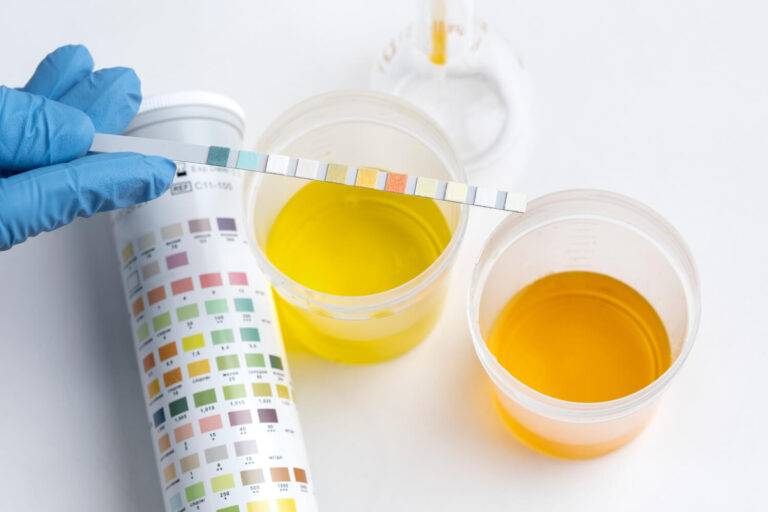 Vroegtijdige opsporing van nierfalen is binnen handbereik