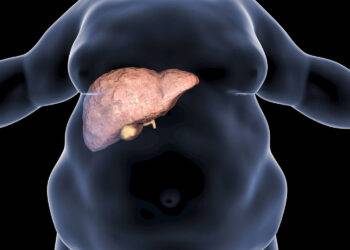 De la NAFLD à la MASLD