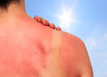 Le soleil, un ami précieux qui ne vous veut pas que du bien.