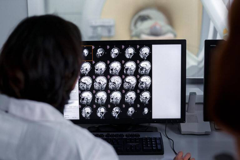 Alzheimer, dépister tôt est possible