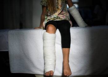 Vitamine D et consolidation des fractures des enfants et adolescents