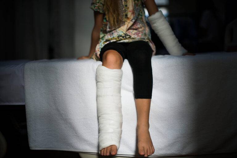 Vitamine D et consolidation des fractures des enfants et adolescents