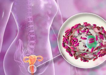 La vaginose bactérienne, une IST méconnue&nbsp;? Une étude du NEJM montre que traiter le partenaire masculin réduit drastiquement les récidives.
