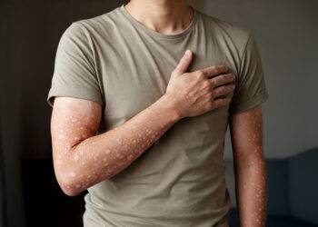 Traitements du psoriasis et risque cardiovasculaire