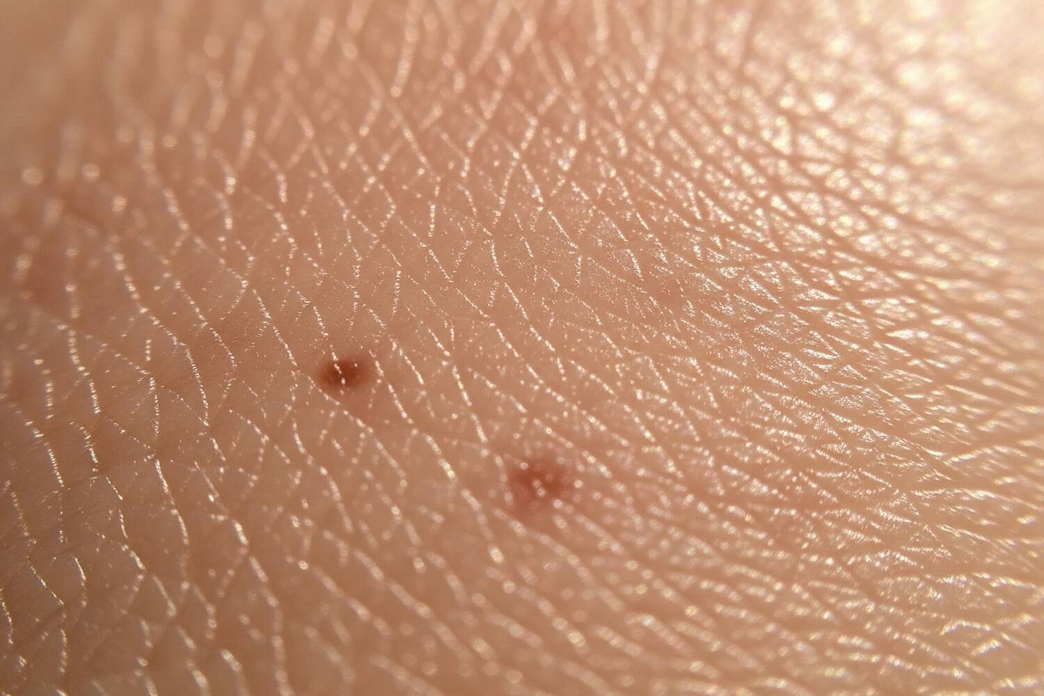 Focus sur la peau, ses fonctions, pathologies et innovations en dermatologie.