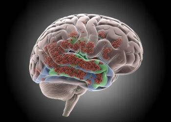 Démence&nbsp;: Parkinson et corps de Lewy, deux visages d’une même maladie&nbsp;?