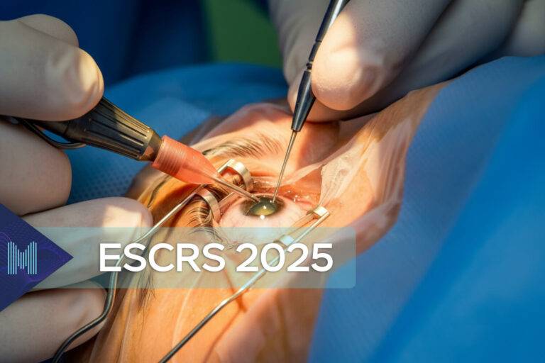 Cataracte bilatérale&nbsp;: une seule opération, de meilleurs résultats&nbsp;?