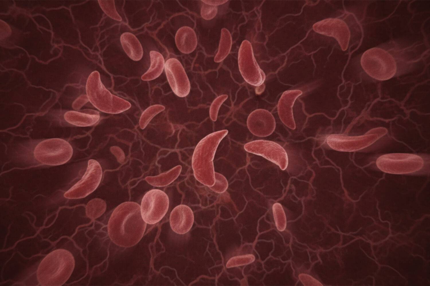 La rigidité d'une faible proportion de globules rouges sous faible pression d'oxygène explique la variabilité des crises de drépanocytose.