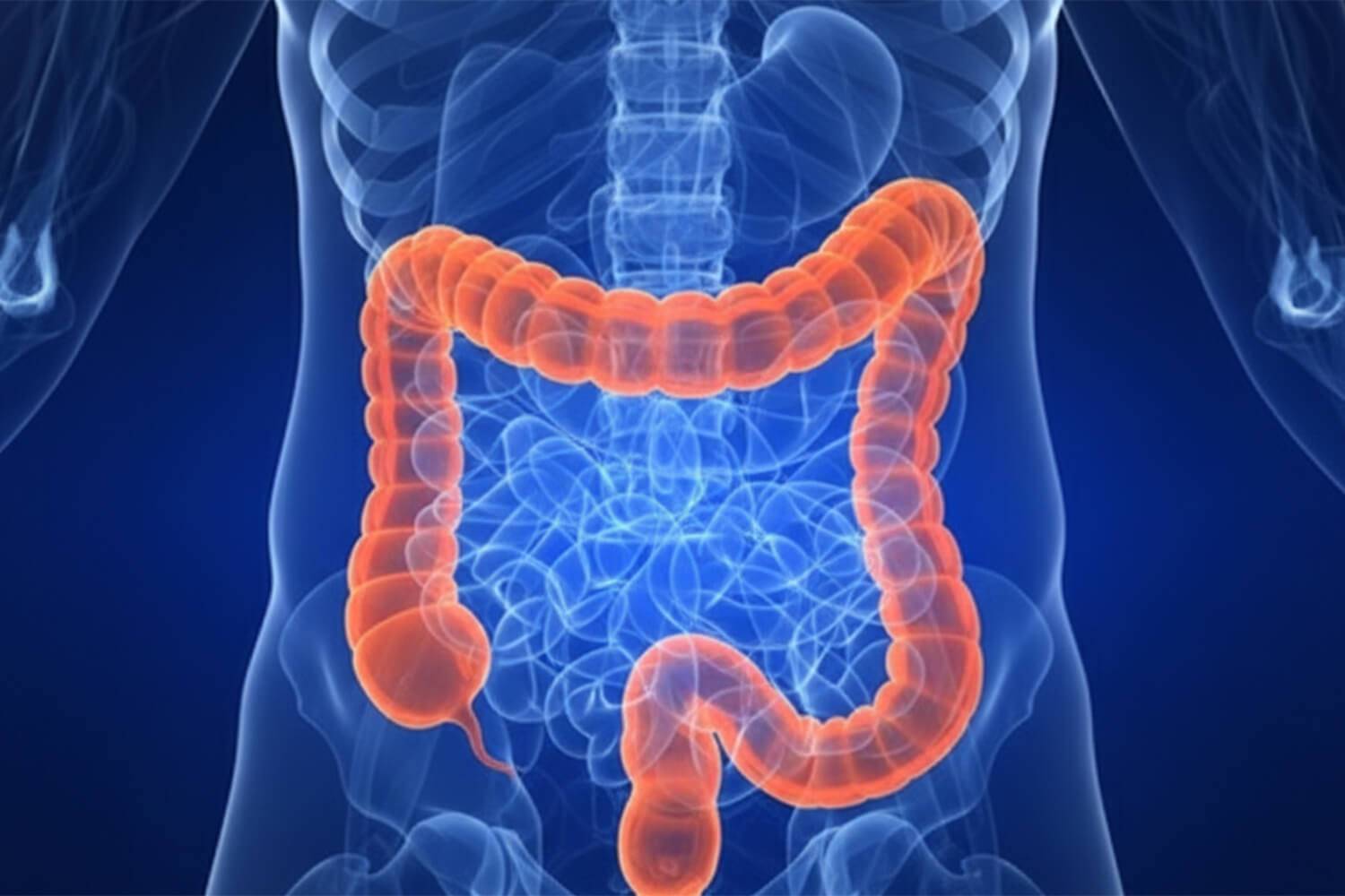 Étude comparative sur 10 ans montrant que l'antibiothérapie réduit les complications par rapport à la chirurgie dans l'appendicite simple