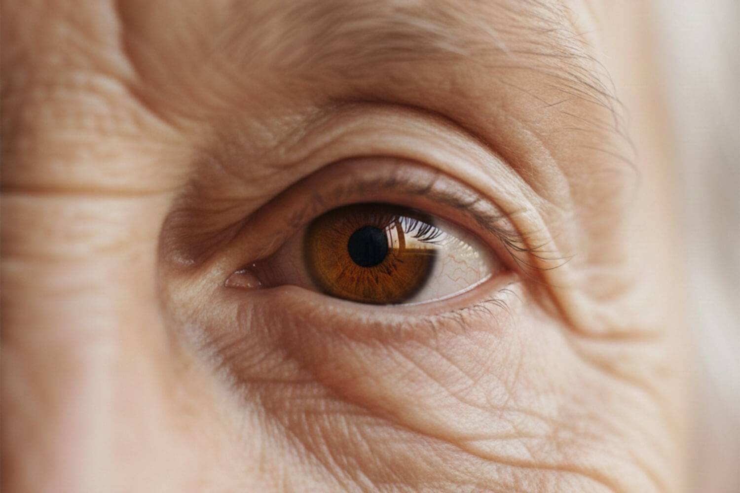 Het gebruik van metformine is geassocieerd met een 37% lager risico op progressie naar een intermediair stadium van LMD.