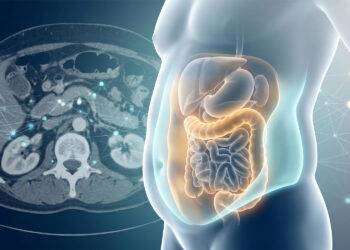 De ratio tussen visceraal en subcutaan vet is een nauwkeurigere indicator voor het risico op type 2-diabetes dan de Body Mass Index (BMI)