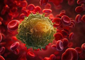 De detectie van dubbel-positieve tumorcellen (CTDP) in het bloed vormt een nieuwe prognostische biomarker voor gevorderde borstkanker.