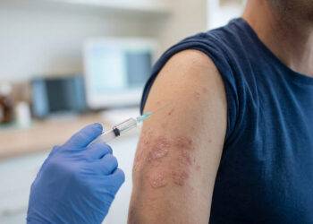 Vergelijking van de cardiovasculaire impact van verschillende systemische behandelingen voor psoriasis, van beschermend profiel tot verhoogd risico.