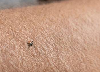 Techniek voor het handmatig verwijderen van een teek op de huid om infecties te voorkomen.