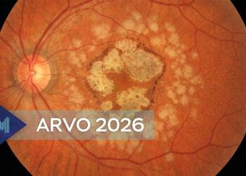 De rol van lipidenbeheer bij maculadegeneratie: hoe verlaging van LDL-cholesterol de retinale perfusie ondersteunt en de achteruitgang van het gezichtsvermogen vertraagt.