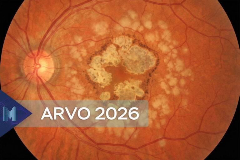 De rol van lipidenbeheer bij maculadegeneratie: hoe verlaging van LDL-cholesterol de retinale perfusie ondersteunt en de achteruitgang van het gezichtsvermogen vertraagt.