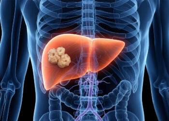 Oncologie en hepatologie: studie van het VIB-KU Leuven naar de rol van leversteatose bij de ontwikkeling van levermetastasen bij darmkanker.