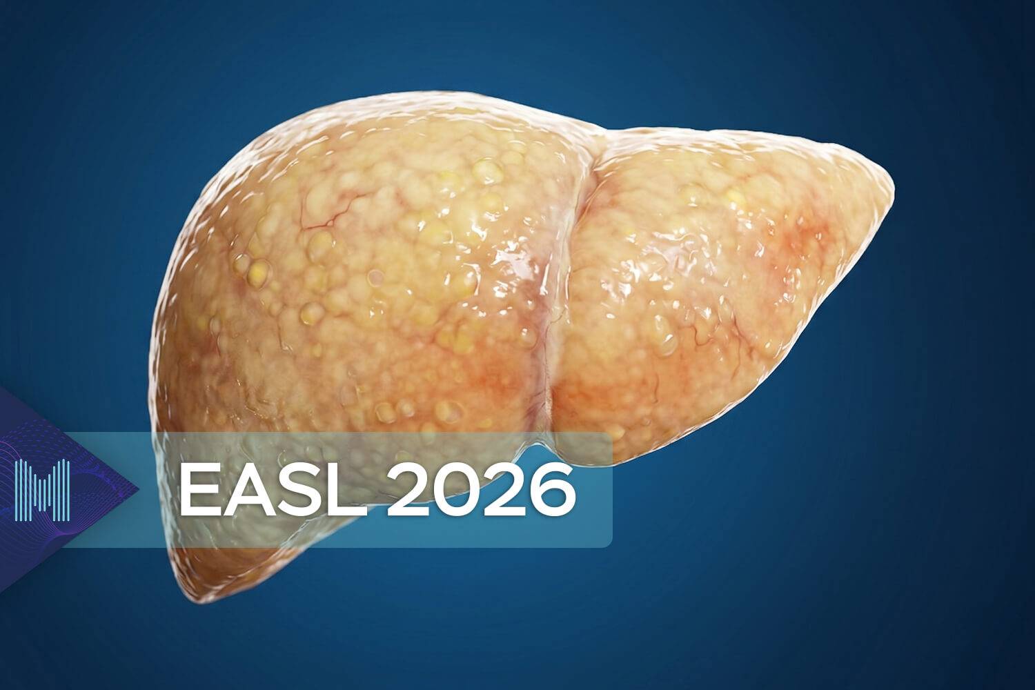Hepatologie en endocrinologie: analyse van metabolische levervetting (MASLD) als systeemziekte en uitdaging voor de volksgezondheid.